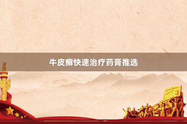 牛皮癣快速治疗药膏推选